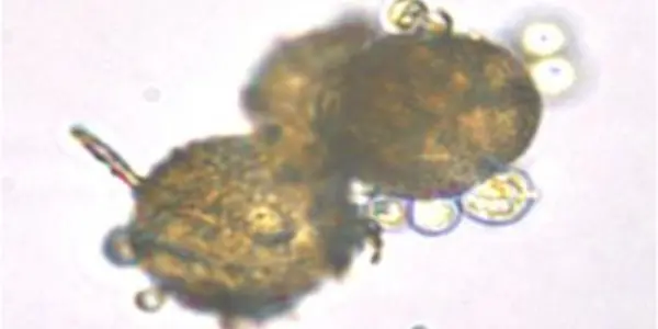 Labyrinthulomycetes:  Crude Oil-Eating Organisms To Get Genomes Sequenced