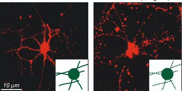 Lipids Are Said To Boost The Brain - But How?