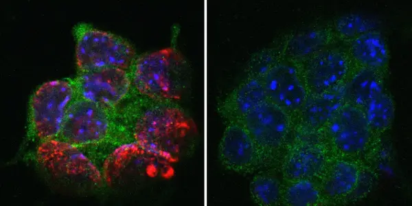 UHRF1: Missing Link Between Epigenetic Tags Histone Modification And DNA Methylation Found