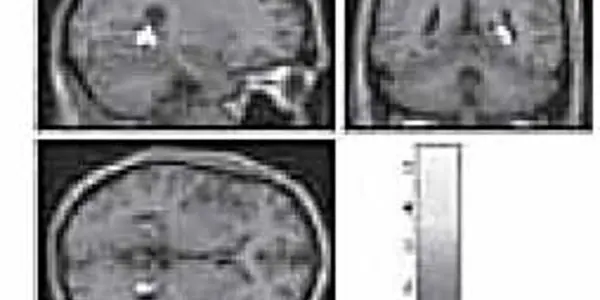 In Search Of 'the Telepathy Center'