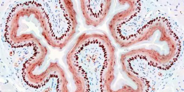 Pluripotency Factor Gene NANOG Is Not Just For Embryonic Stem Cells