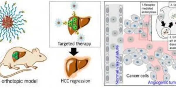 Modern Traditional Chinese Medicine: Triptolide Plus Nanotech Could Improve Cancer Treatment