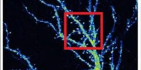 OPHN1: Mutated X-linked Mental Retardation Protein Impairs Neuron Function