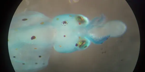 Stained Squid, Part II