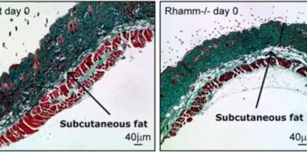 RHAMM - The Protein That May Eliminate Wrinkles