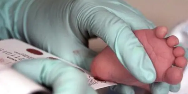 Screening Test Reliably Detects Inherited Immune Deficiency In Newborns