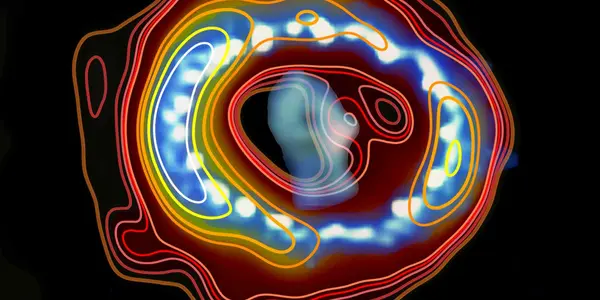 What's Still Powering Supernova Remnant 1987A?