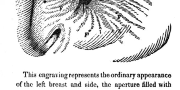 William Beaumont: The Father Of Gastric Physiology And His Odd Experiment