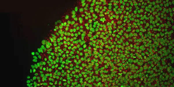 The Internal Debate Over Stem Cell Research