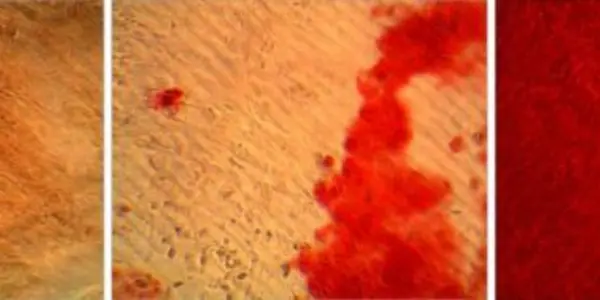 Making Bone From Fat Cells