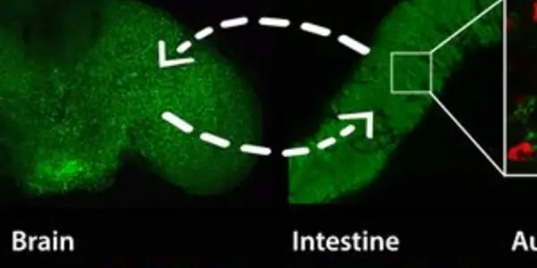 Biologists Delay The Aging Process By 'Remote Control' Of A Gene
