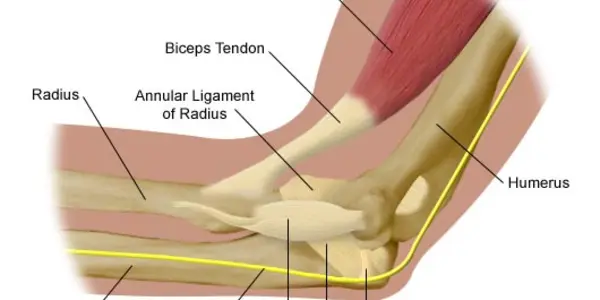 Predicting Which Players Will Need Tommy John Surgery May Reduce Their Risk
