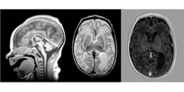 Sorry NPR Listeners, This Meat, Egg And Dairy Nutrient Is Essential For Brain Development