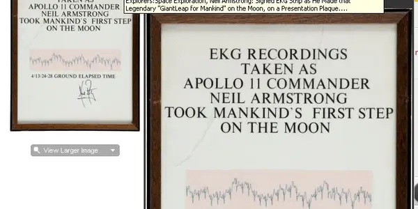 Two Armstrong EKG Readings - A Question Of Provenance