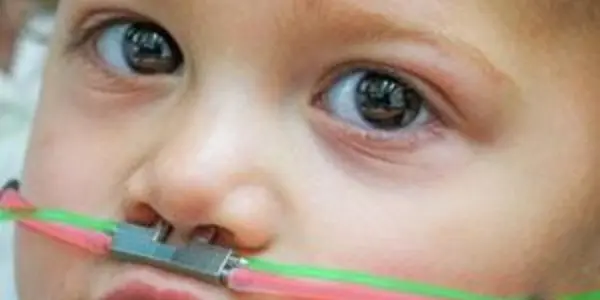 Non-Verbal Smell Test May Be Indicator Of Autism