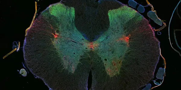 Cancer Drug Epothilone Causes Damaged Nerve Cells In Spinal Cord Injuries To Regrow