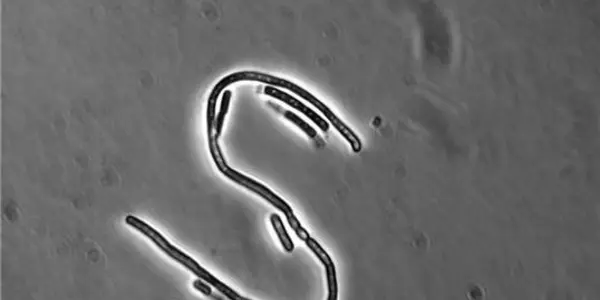 Bacillus Cereus Is Able To Resist Antibiotic Therapies