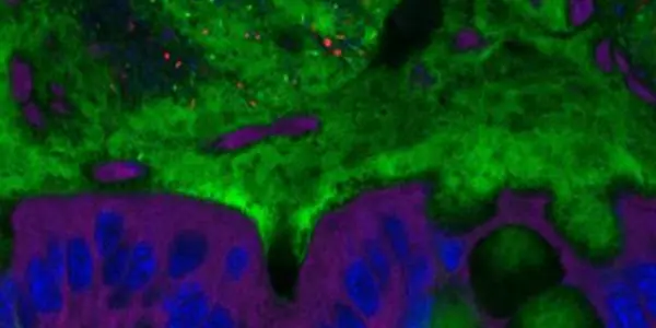 Emulsifiers Promote Obesity And Colitis In Mice