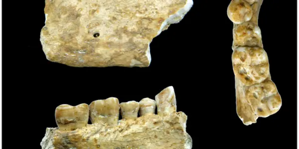 Neolithic Dentistry In 4,500 B.C.