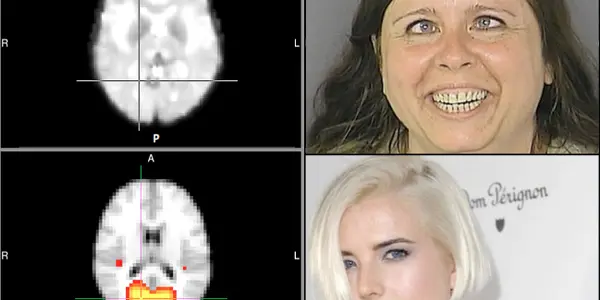FMRI Study Finds That Mindfulness More Effective Than Scientology At Clearing Thetans
