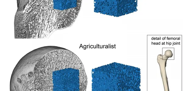 Farming Made Humans Fragile