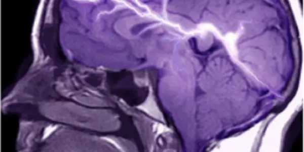 Human Brain and Mind 2: More Neuroplasticity