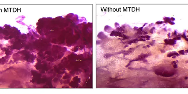 MTDH Breast Cancer Gene Needs A Partner To Create Tumors