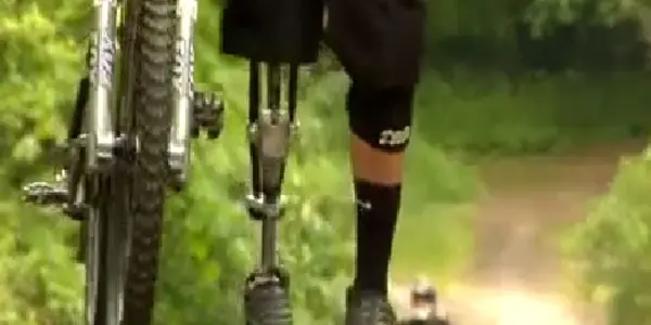 DIY Prosthetics: How An Athlete Who Wanted To Ski Again Built A New Kind Of Knee