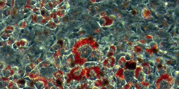 Not All Fat Is Equal: Amping Up Adenosine May Melt 'Love Handles'