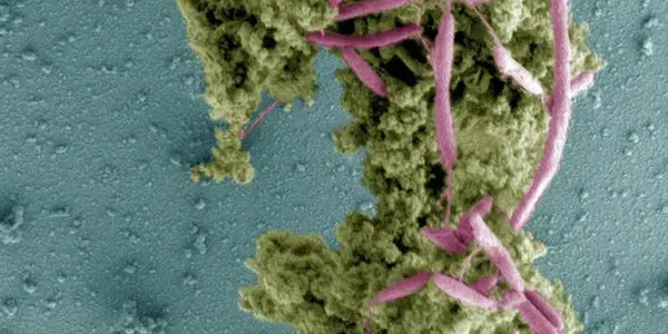 Wash Your Cutting Board: The Science Of How Campylobacter Exploits Chicken Juice