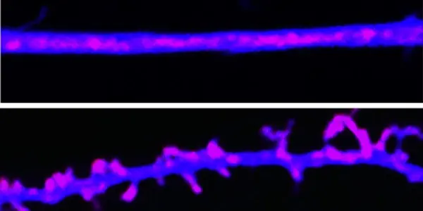 Long-Term Memories Maintained By Prion-Like Proteins