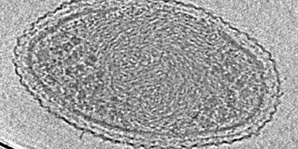 How Small Can Life Get? These Ultra-Small Bacteria May Be At The Limit