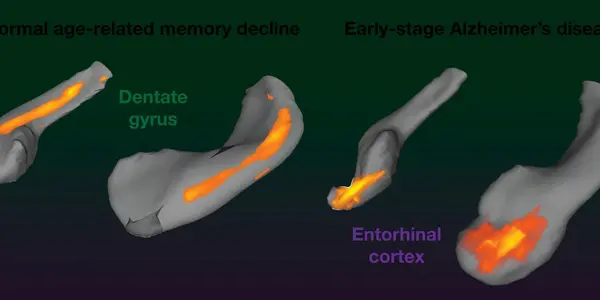 Cocoa Flavanols Reverse Age-Related Memory Decline