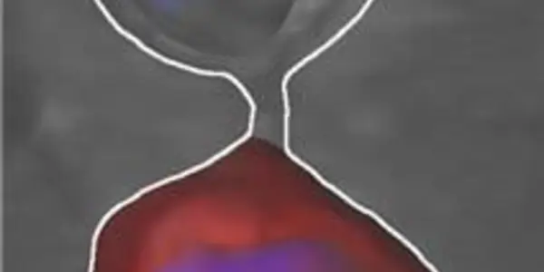 A Barrier Against Brain Stem Cell Aging