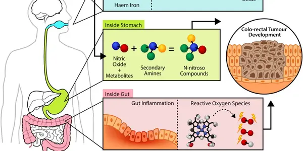 Will Eating Red And Processed Meat Lead To Cancer? The Science Answer