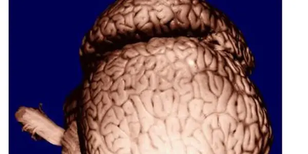 Building Smarter Artificial Intelligence By ... Shrinking The Body?