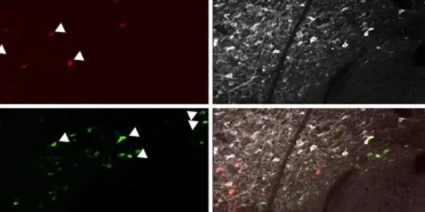 Dopamine Discovery May Bring Freedom From Irrational Fear