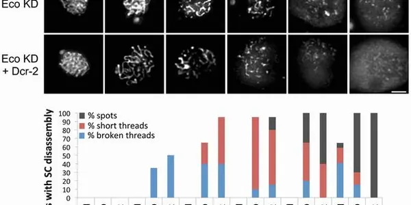 Maternal Age Effect: Molecular Mechanisms Of Birth Defects Among Older Women