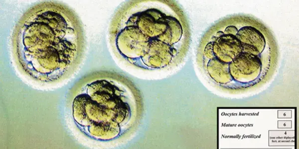 Octomom, Genetic Engineering And A Brave New World: The Ethics Of IVF