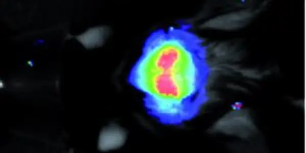 Epilepsy Switch Discovered