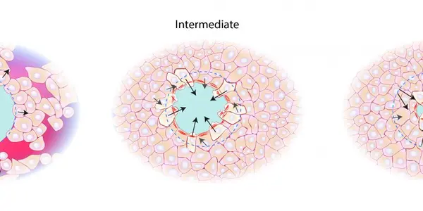 Skin Wounds: How Epithelial Cell Sheets Force Them To Close