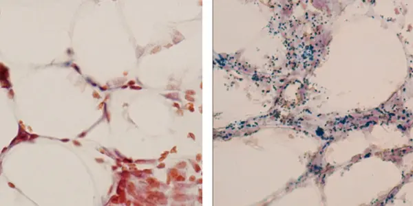Fat Cells Under The Skin Help Protect Us From Bacteria