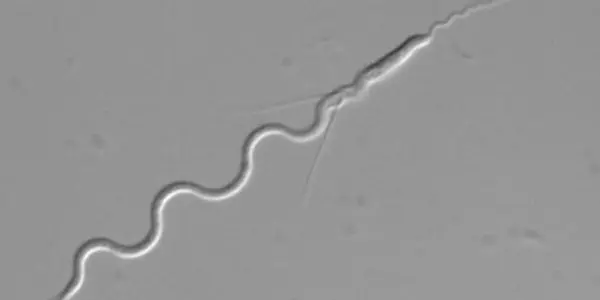 Sperm Wars In The Fight For Promiscuity