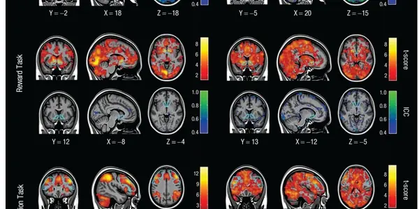 FMRI Images Are Just Pretty Pictures