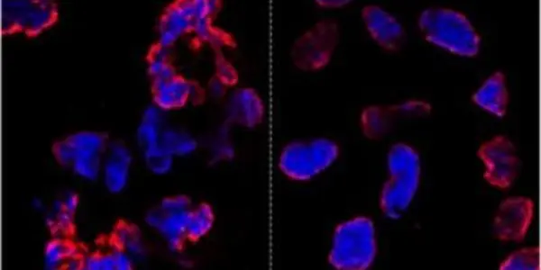 Genetically Modified Stem Cells Don't Increase Mutations