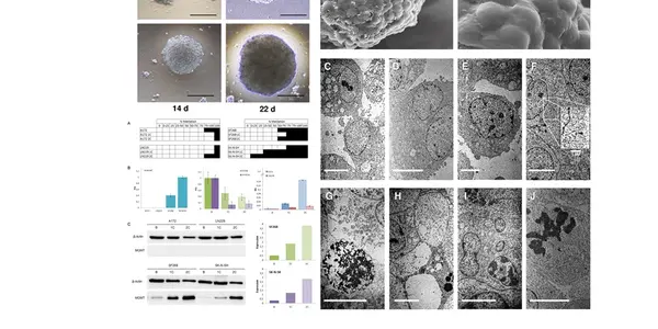 New Data On Why Most Aggressive Brain Tumor Treatments Fail