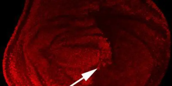 Tissue-Specific Cancers - Repressing The Repressors