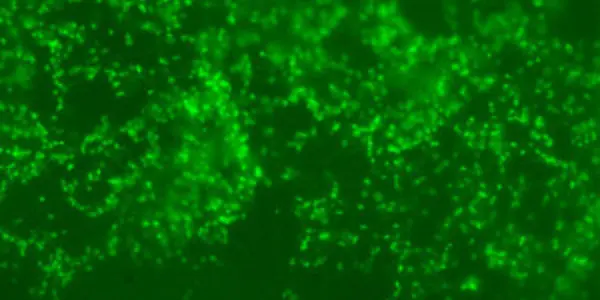 Nature Versus Nurture: Going To Extreme For Enzymes