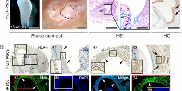Induced Pluripotent Stem Cells From Urine Used To Create Human Tooth