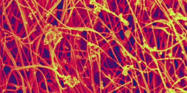 4 Mechanisms That Make Our Skin So Resistant To Tearing